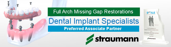 Thailand Dental Implants