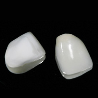 Porcelain veneers