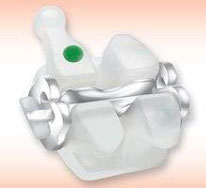 Clear Braces