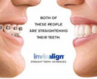 Thailand Dental Invisalign