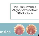 STb Braces