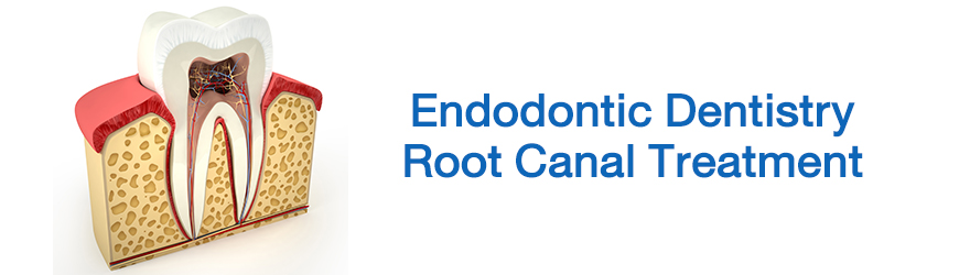 Endodontic Dentistry/ Root Canal Treatment