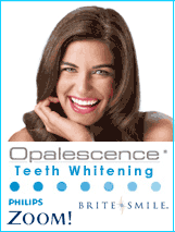 Teeth Whitening